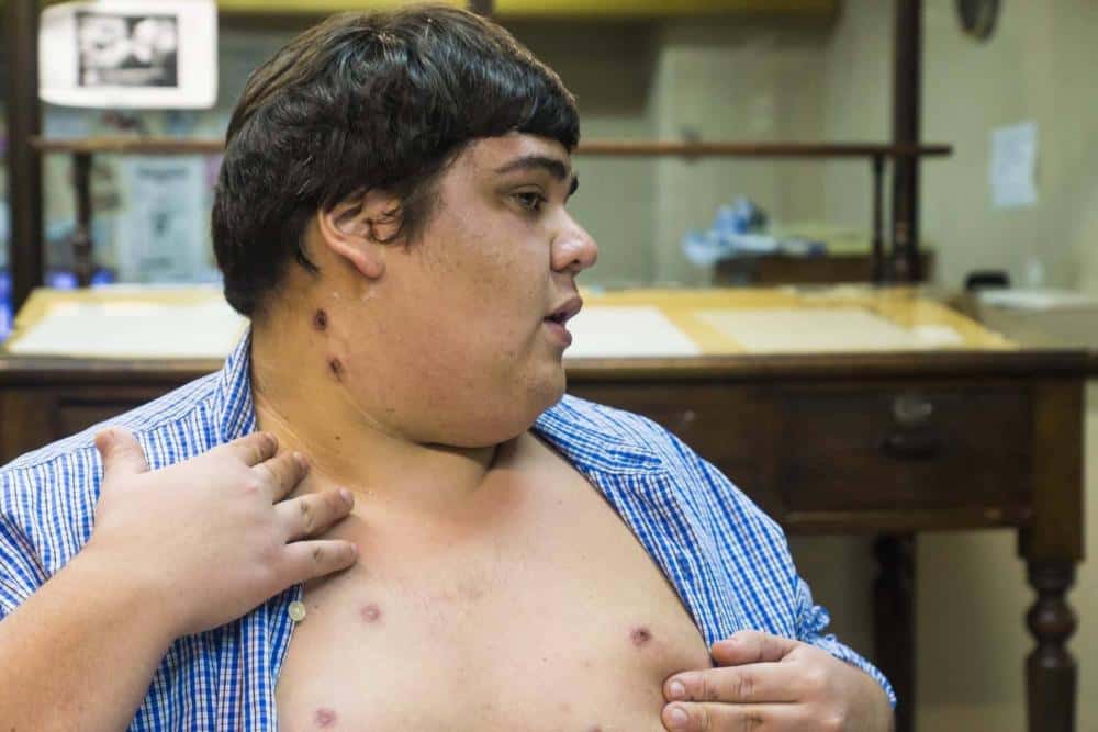 Un joven denunció que la policía  le provocó 30 heridas de bala  de goma en el show de La Renga
