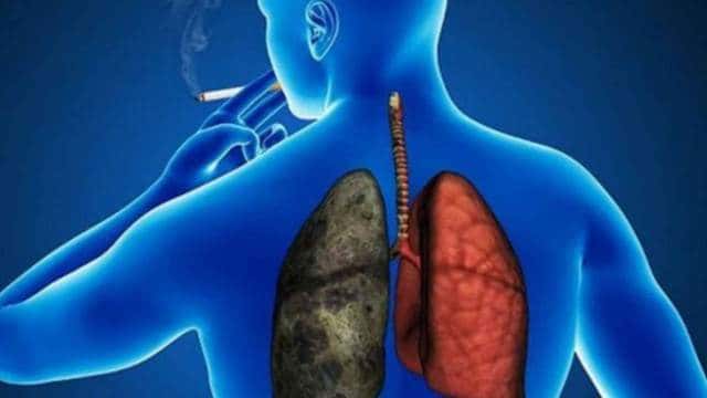 En un congreso en Córdoba, presentaron avances  alentadores en el tratamiento del cáncer de pulmón