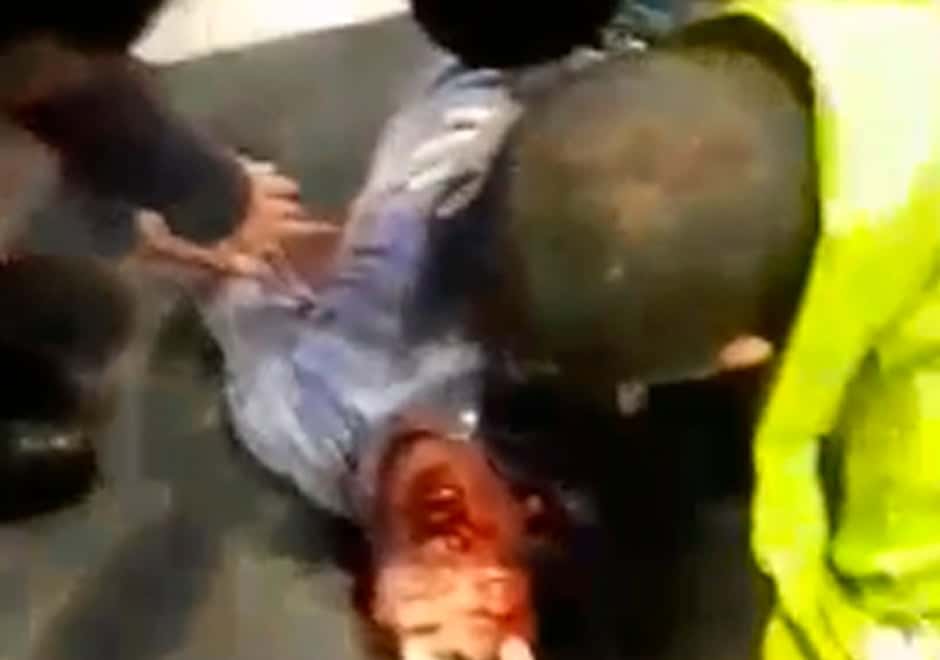 El video del momento que se llevaban al joven golpeado a la salida de un boliche