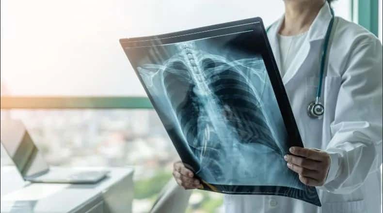 Fibrosis Pulmonar Idiopática, cuando los pulmones suenan como un velcro