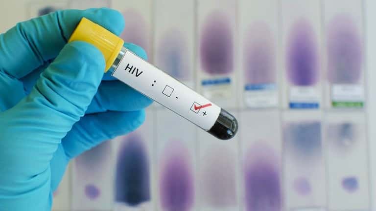 Tratamiento biterapia permitiría mejorar la adherencia en el abordaje del VIH