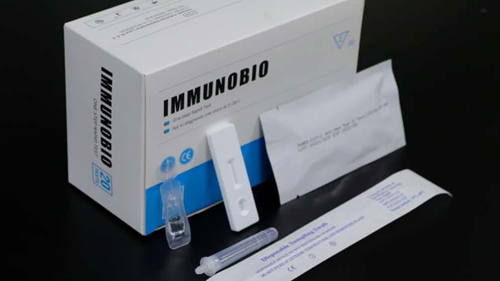 Autorizaron la venta en farmacias de un test rápido para detectar Covid-19