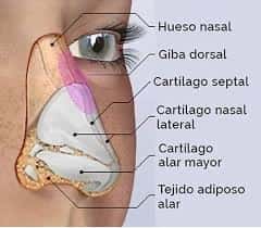 Reconstrucción nasal con cartílagos autólogos