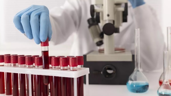 La leucemia mieloide crónica afecta a una de cada 100.000 personas.