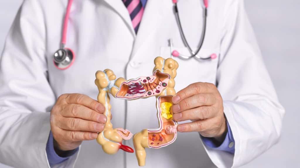 Cuántos casos de cáncer de colon se diagnostican a diario