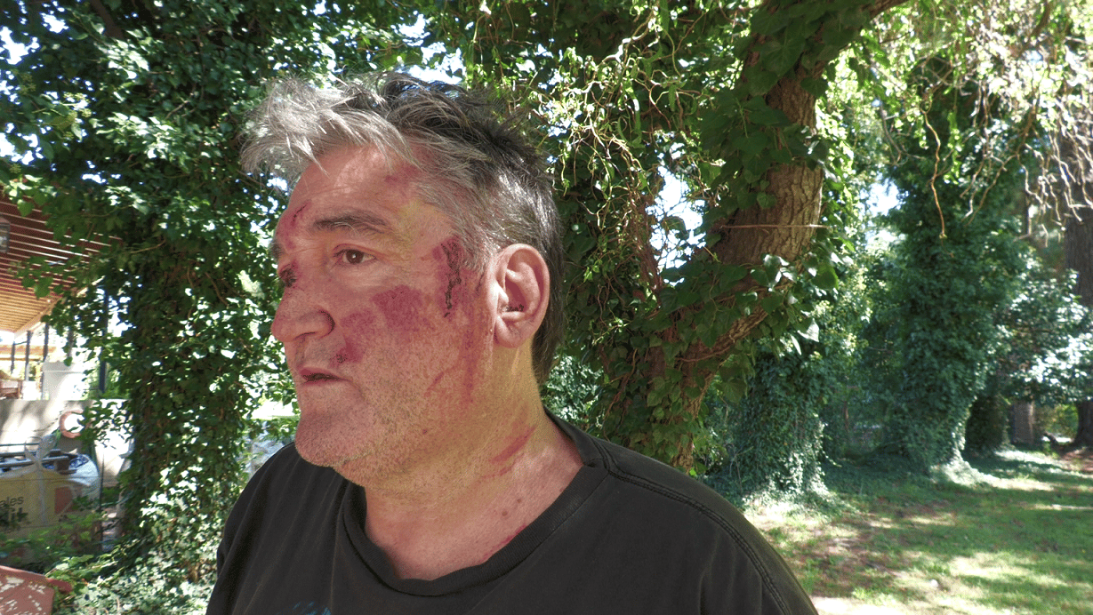 El relato del vecino golpeado por delincuentes en Don Bosco: “Estaban sacados”