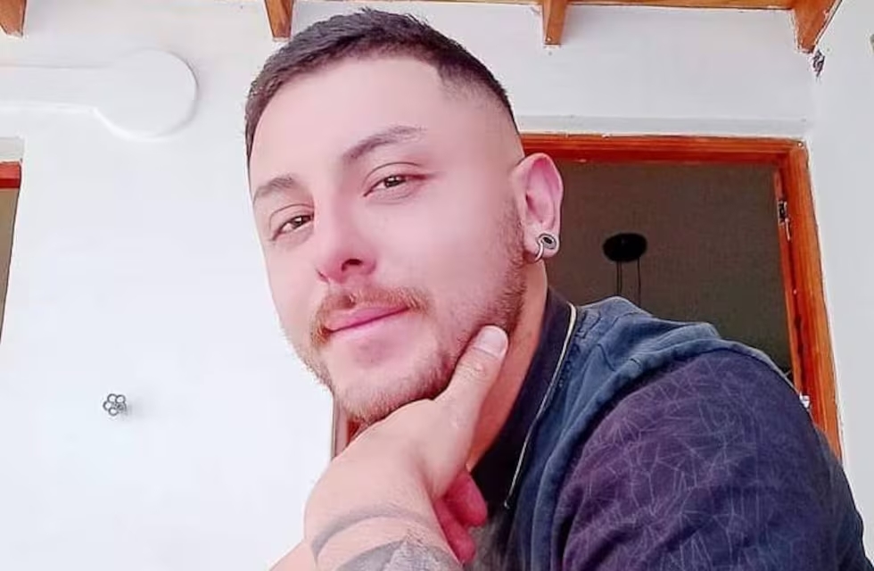 Falleció el joven argentino que había sido internado en México tras contagiarse viruela del mono