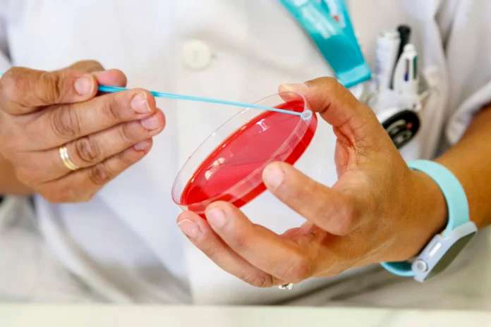Advirtieron por crecimiento de la sífilis con cifras récord en 2023 y tendencias que siguen en alza